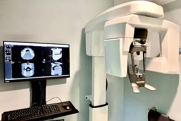 Our Technology in Groton Intraoral camera Groton Digital x-rays conebeam ct scan