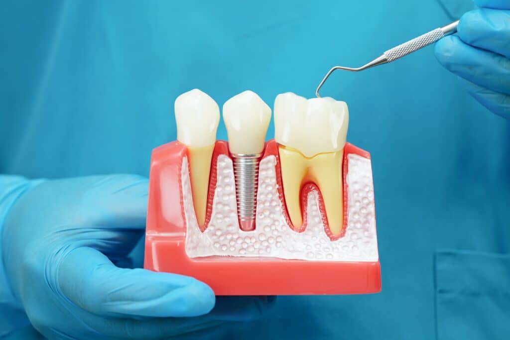 Implant Dentist Groton